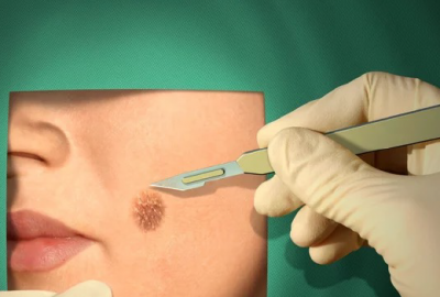 PLASTIC SURGERY