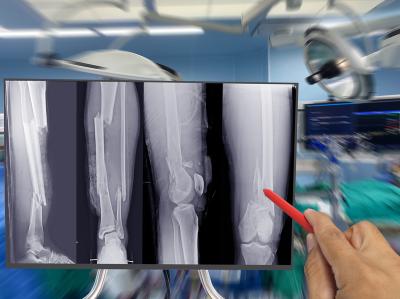 SURGICAL TREATMENT OF FRACTURES