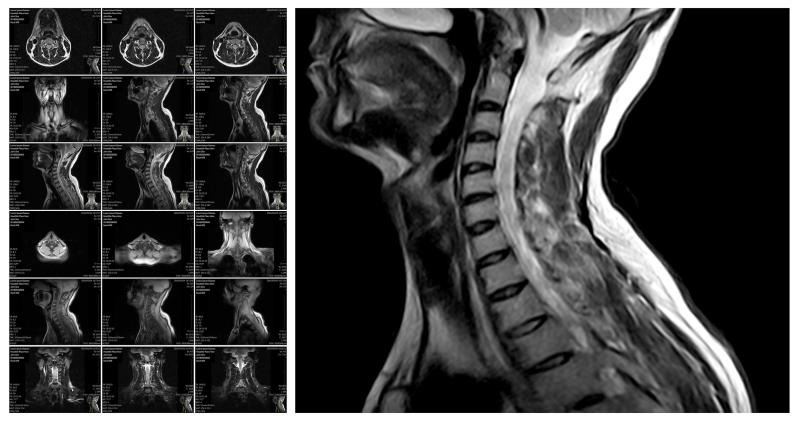 MAGNETIC RESONANCE